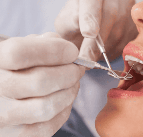 What is Restorative Dentistry?