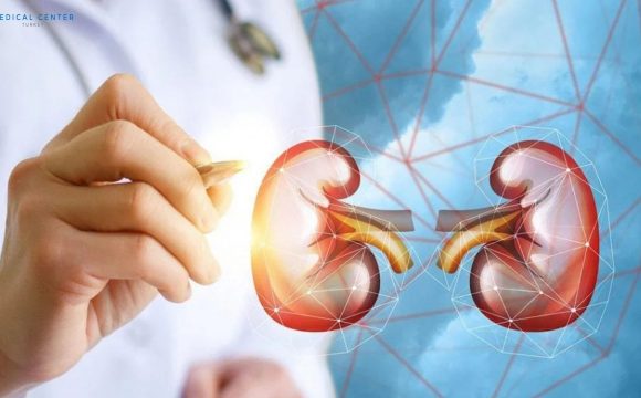 Kidney Transplant in Turkey