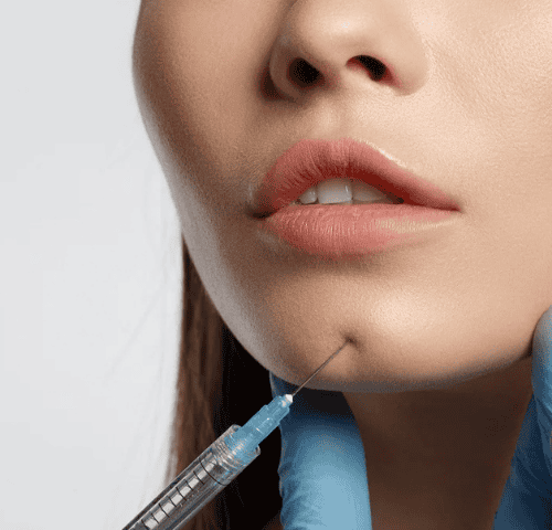 Fat Transfer to Face in Turkey