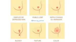 Breast Cancer Surgery in Turkey