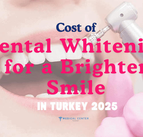 Cost of Dental Whitening for a Brighter Smile in Turkey 2025