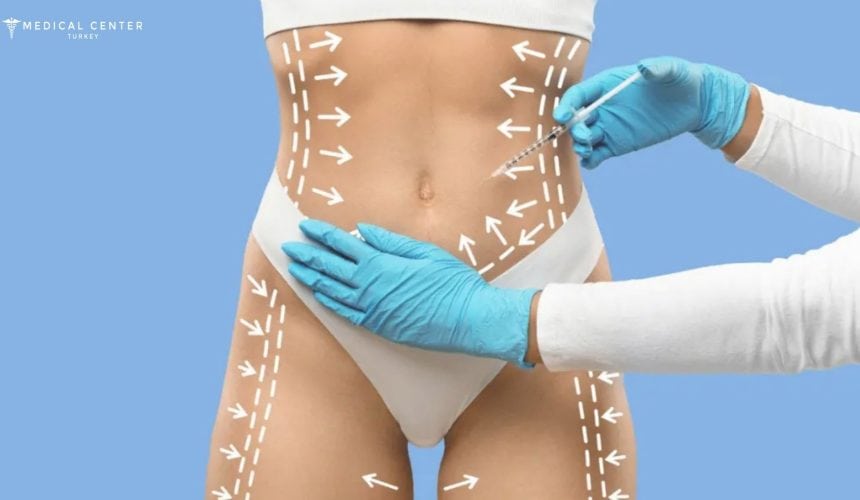 Laser Lipo vs. Vaser Lipo: Which is Better for 2025? Laser Lipo vs. Vaser Lipo: Which is Better for 2025?