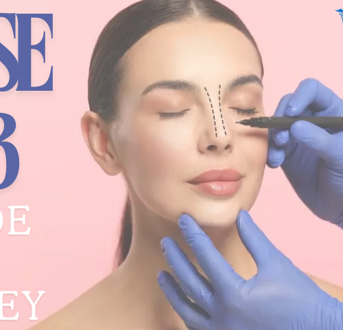 Nose Job Guide in Turkey