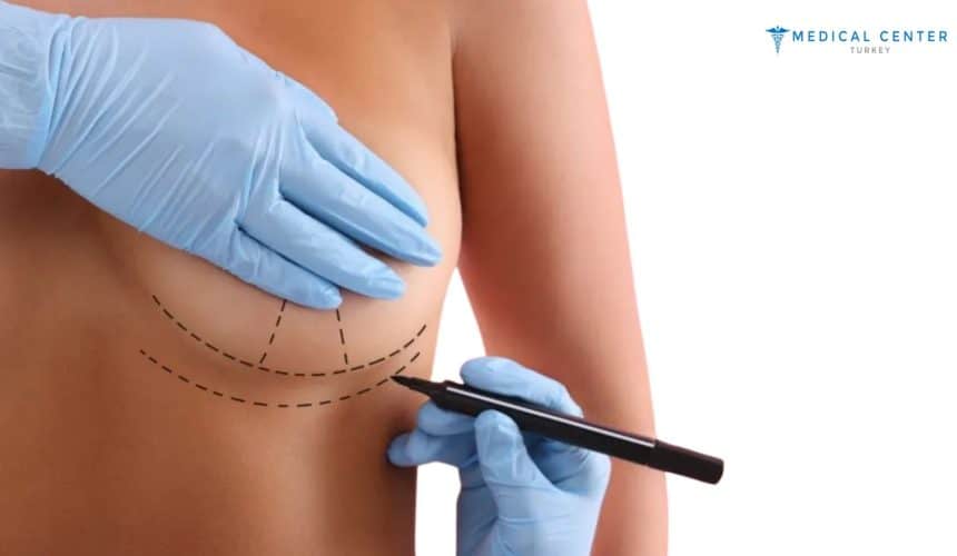 Is Breast Augmentation Still a Popular Choice for 2025? Is Breast Augmentation Still a Popular Choice for 2025?