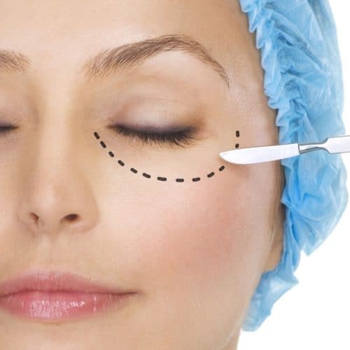 Eye Lift in 2025: Say Goodbye to Droopy Eyelids
