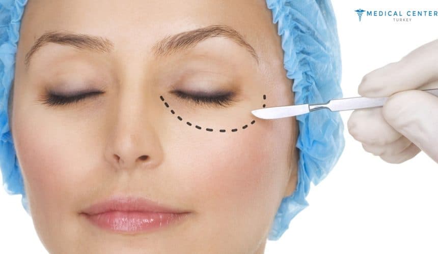 Eye Lift in 2025: Say Goodbye to Droopy Eyelids Eye Lift in 2025: Say Goodbye to Droopy Eyelids