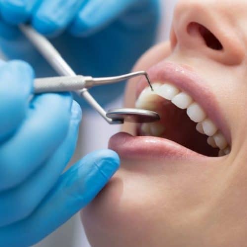10 Best Countries for Dental Implants