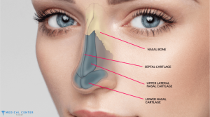 The Pros and Cons of Rhinoplasty Surgery Abroad in 2025