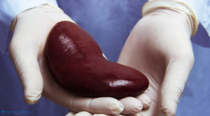 Transplant Surgery in Turkey 2025
