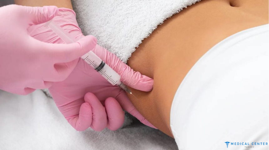 Fat Injection in 2025