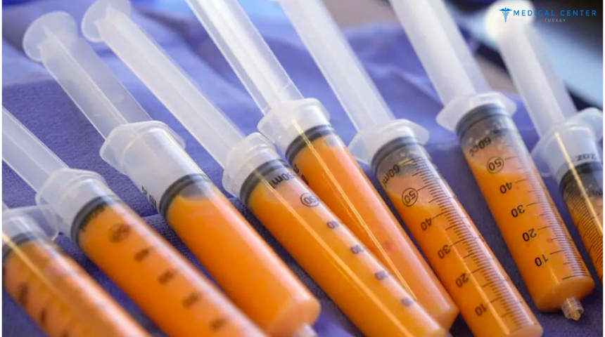 Fat Injection in 2025