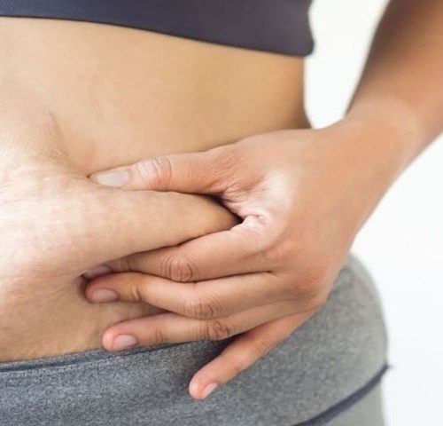 Gastric Bypass vs Gastric Sleeve: What’s Best?