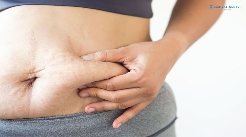 Gastric Bypass vs Gastric Sleeve: What’s Best? Gastric Bypass vs Gastric Sleeve: What’s Best?