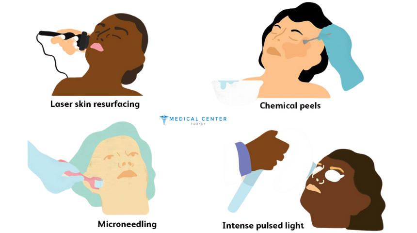 What’s New in 2025 for Facial Rejuvenation