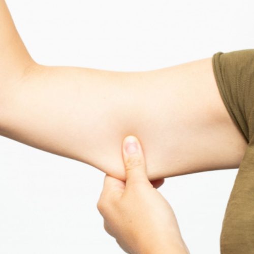 Why 2025 is the Best Time to Get a Mini Arm Lift?