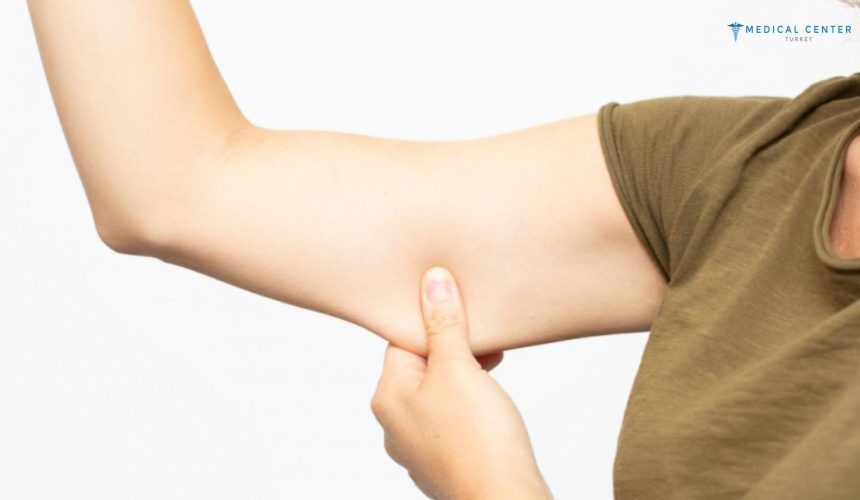 Why 2025 is the Best Time to Get a Mini Arm Lift? Why 2025 is the Best Time to Get a Mini Arm Lift?