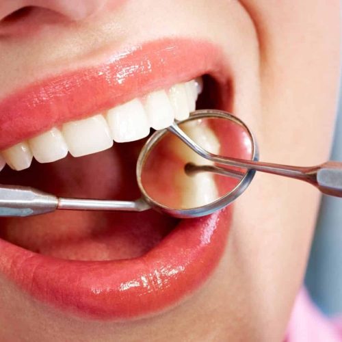 Is Dental Treatment Reliable?