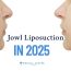 Jowl Liposuction in 2025