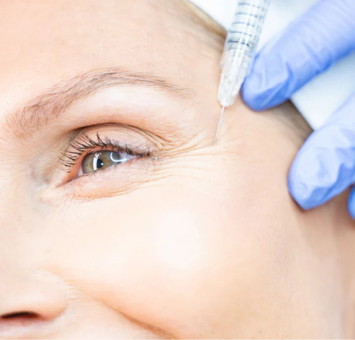 Is Botox Worth it in 2025? Is Botox Worth it in 2025?