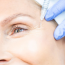 Is Botox Worth it in 2025?