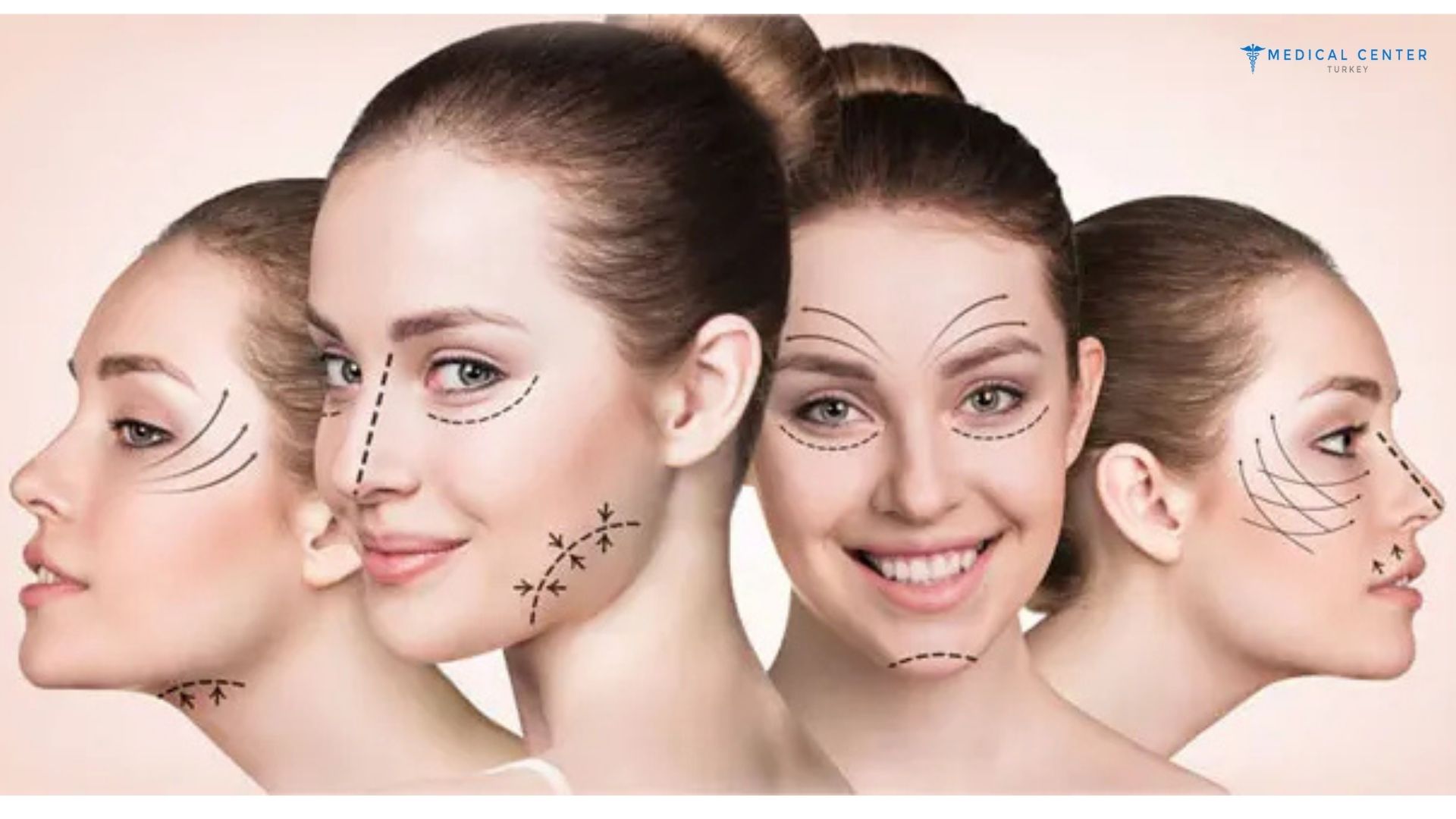 What Should I Know Before Having Cosmetic Surgery in Turkey?
