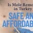 Is Mole Removal in Turkey Safe and Affordable?