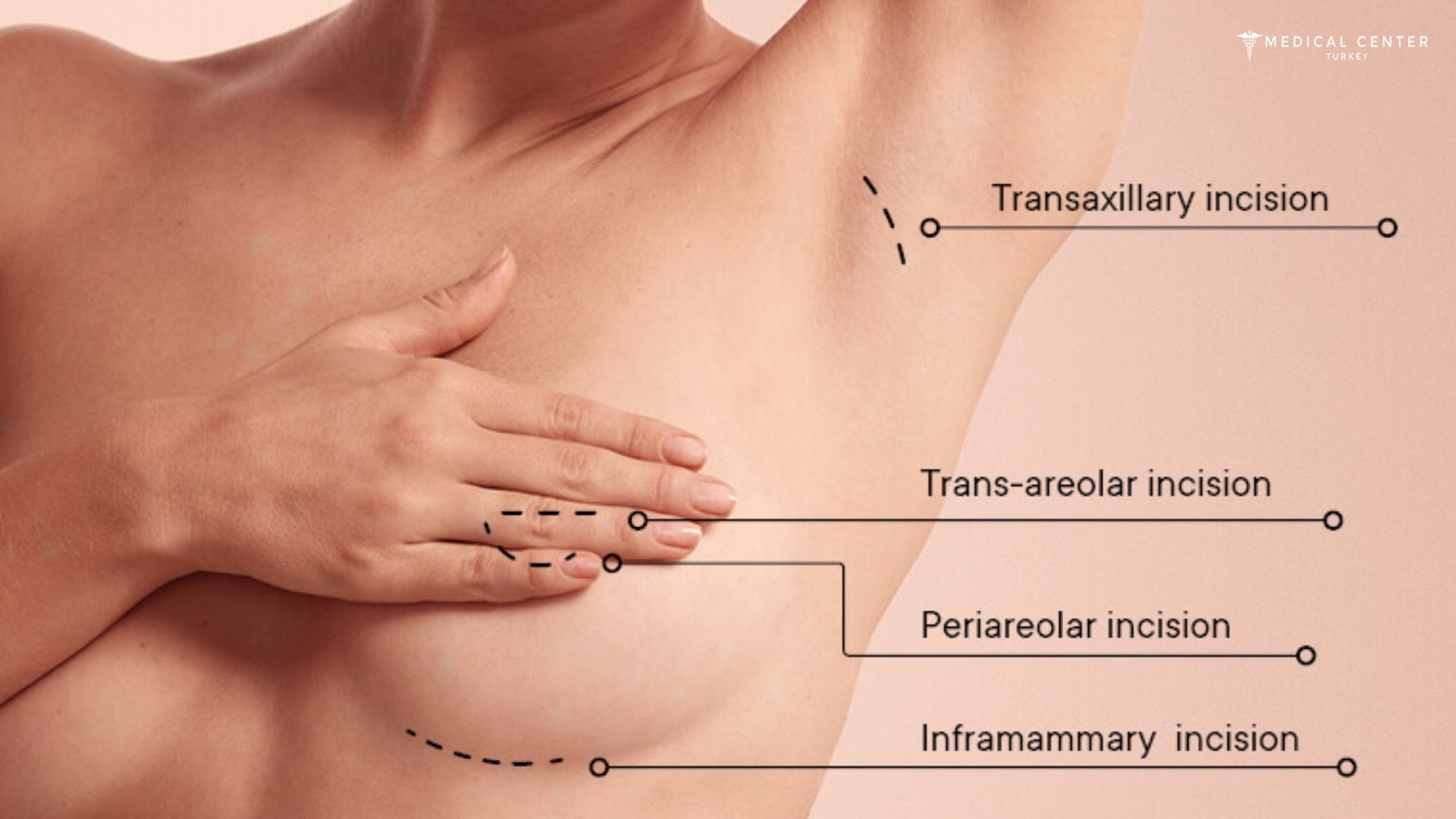 How Painful is Breast Reduction in Turkey 2025?