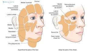 How Much Does Fat Transfer to Face Cost in Turkey 2025?