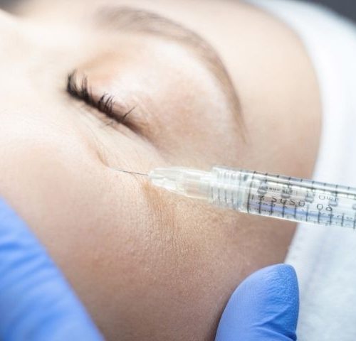 What Should You Know About Under Eye Fillers in 2026? What Should You Know About Under Eye Fillers in 2026?