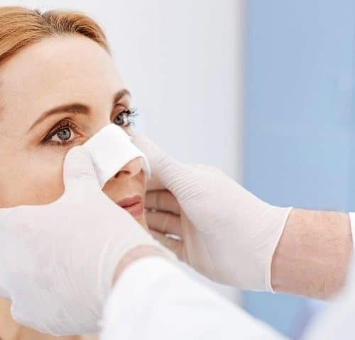 Which Is Better Open or Closed Rhinoplasty?