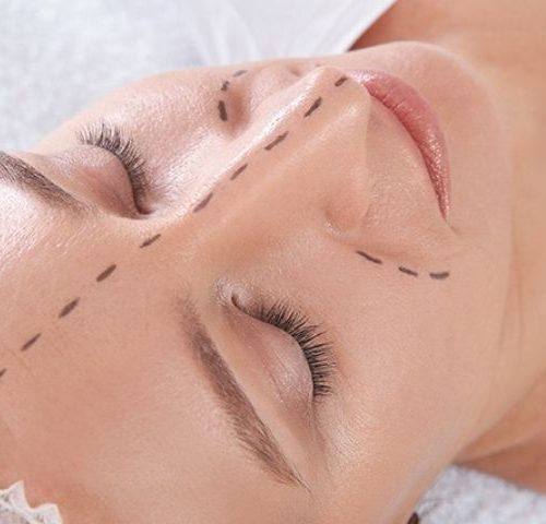 Why Is Preservation Rhinoplasty So Popular in 2026?