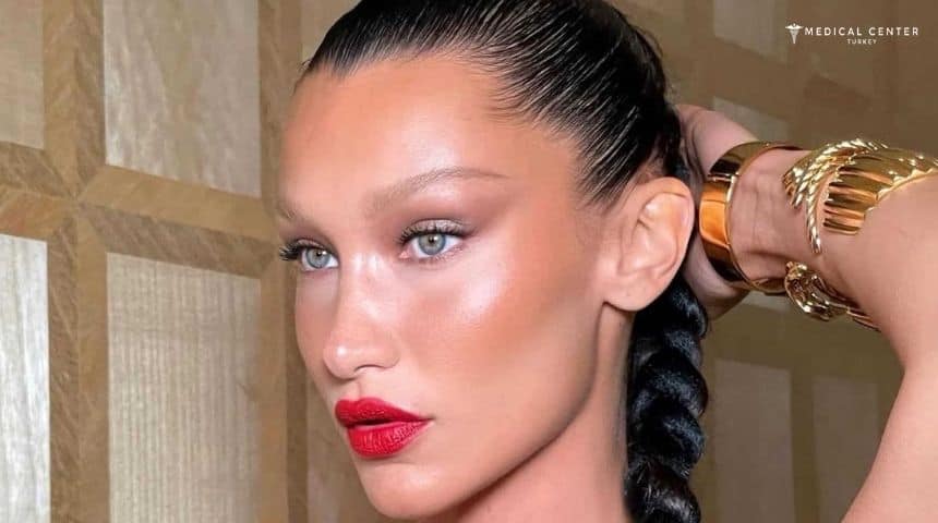 Bella Eyes Surgery in Turkey