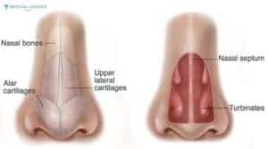 Is Turkey Still The Best Place For Nose Jobs?