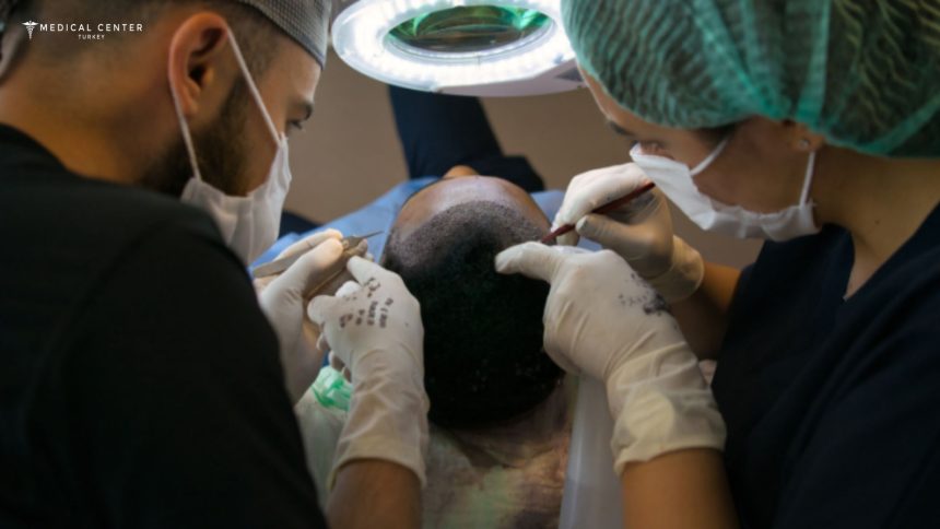 Which Hair Transplant Technique Works Best in 2026? Which Hair Transplant Technique Works Best in 2026?