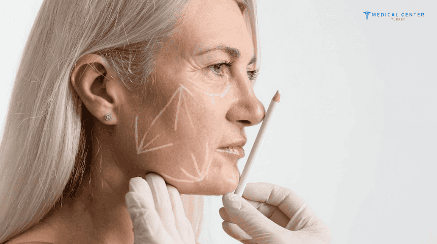 What’s New in Facelift Surgery in Turkey?