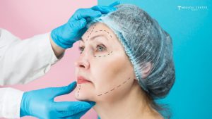 Why Deep Plane Facelifts are Trending?